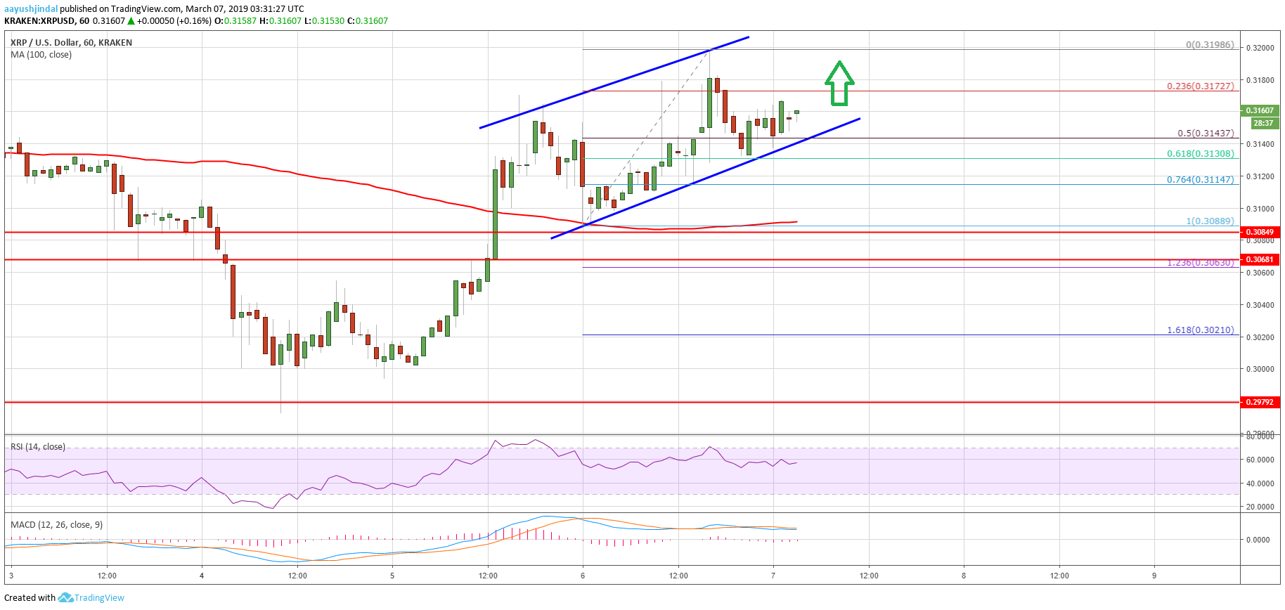 Ripple price analysis: xrp could rally significantly if it breaks $0. 3200 Ripple price analysis xrp chart