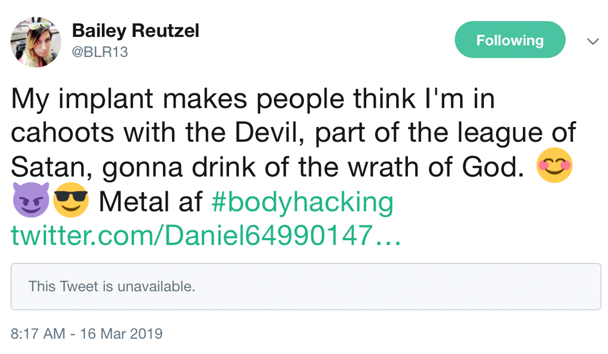 Installing a subdermal bitcoin wallet is only for the brave Installing a subdermal bitcoin wallet is only for the brave