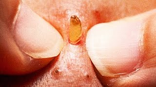 Spots & blemishes! Why do we love it? Spots & blemishes! Why do we love it?