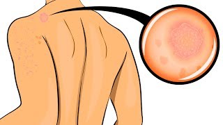 10 signs that your body is very stressed 10 signs that your body is very stressed